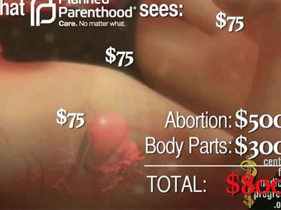 Foetus à vendre : l'horreur en marche L'Homme Nouveau